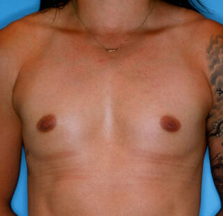 Patient 9 before