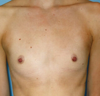 Patient 13 before